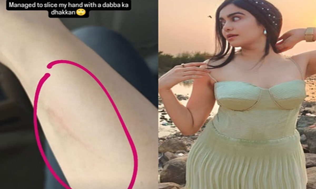 Adah Sharma Hilariously ‘Sliced’ Her Hand with ‘Dabba Ka Dhakkan’ 1 Adah Sharma Hilariously ‘Sliced’ Her Hand with ‘Dabba Ka Dhakkan’