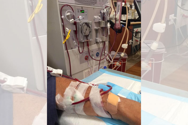 Free Dialysis to HIV/Aids & Hepatitis Patients