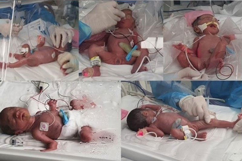 Quintuplets born for 1st time in 34 yrs in S.Korea