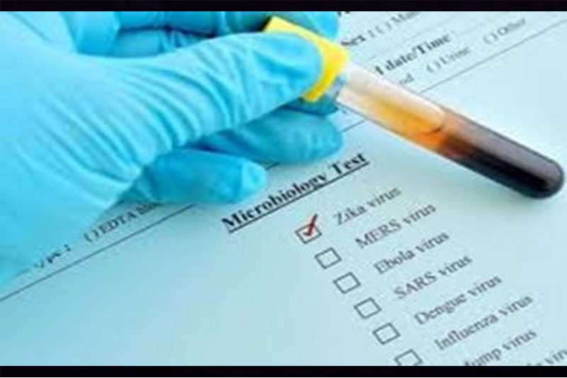 Two Zika virus cases found in UP's Lucknow