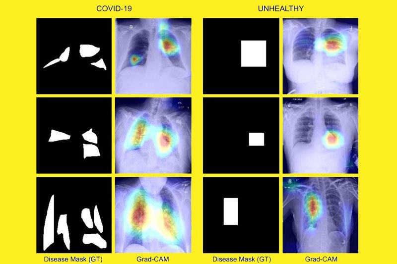 IIT Jodhpur team develops Covid diagnosis technique using chest X-Ray