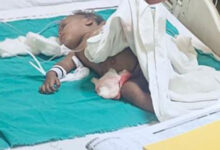 Toddler dies after being attacked by stray dogs in Noida