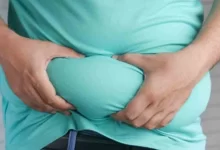 Tips to manage obesity