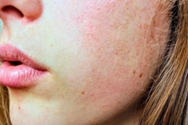Skin slugging: Ace your winter glow