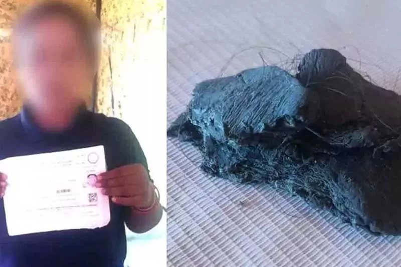 Telangana woman pastes M-Seal in hair to increase height for police job