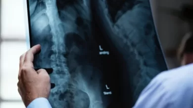 Experts discuss advances in spinal cord injury care, rehab