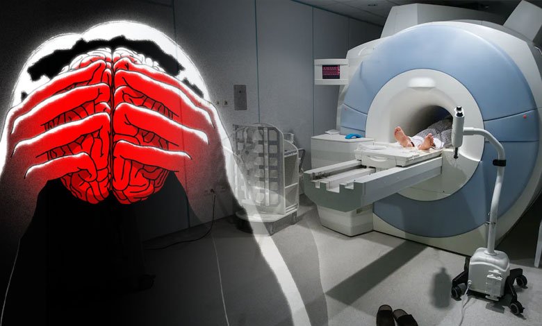 New MRI technique may relieve depression symptoms up to 6 months