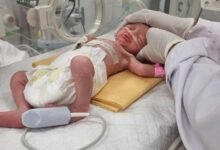 A Palestinian baby in Gaza is born an orphan in an urgent cesarean section after an Israeli strike