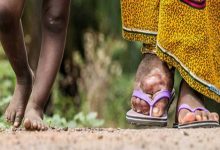 How India is fighting against lymphatic filariasis