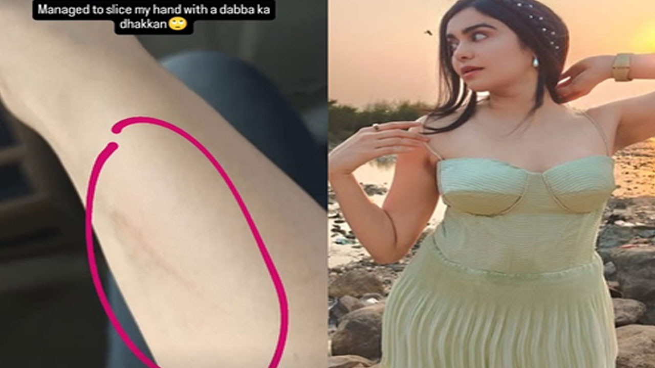 Adah Sharma Hilariously ‘Sliced’ Her Hand with ‘Dabba Ka Dhakkan’