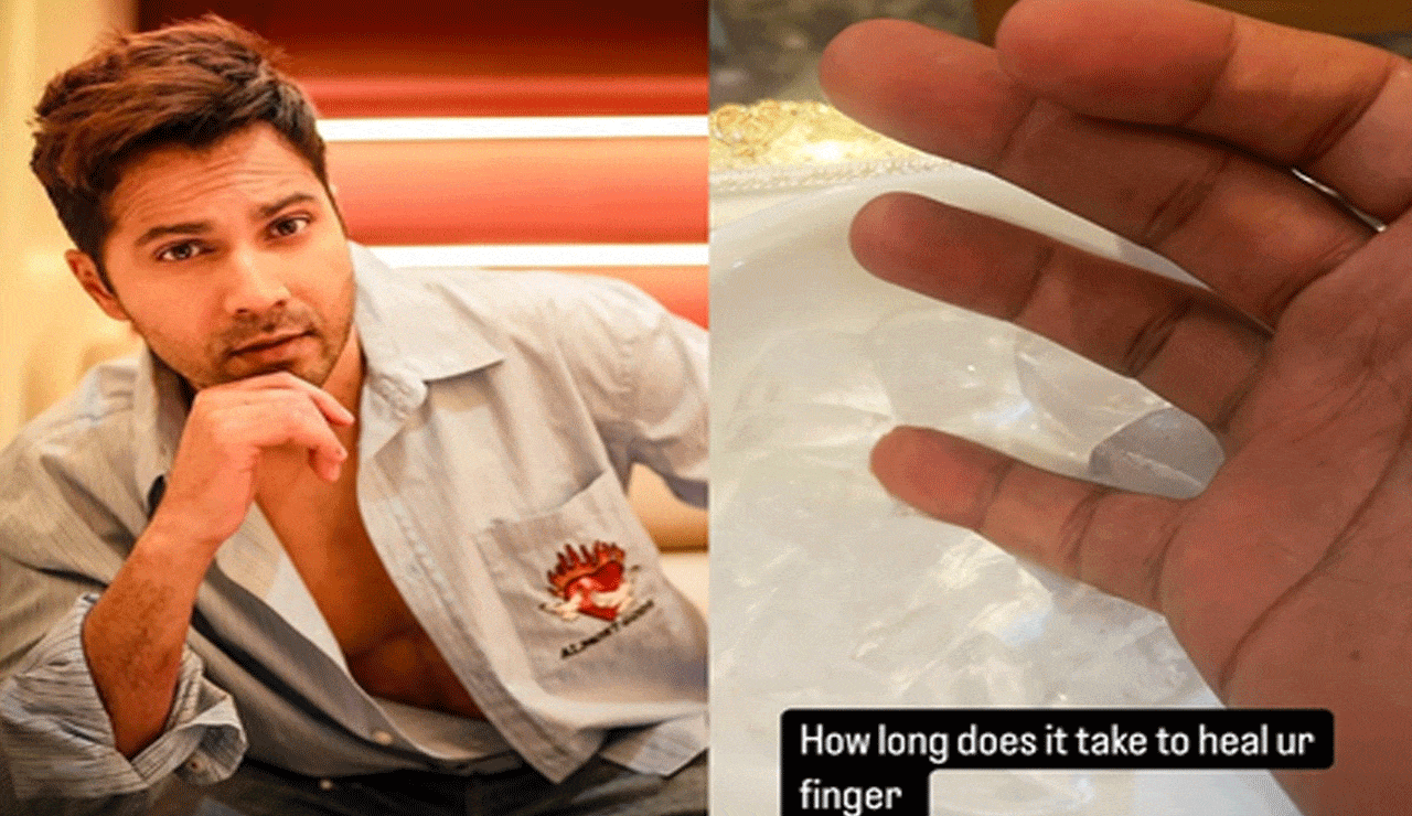 Varun Dhawan Suffers a ‘Work Injury’, Asks ‘How Long Does It Take to Heal?’
