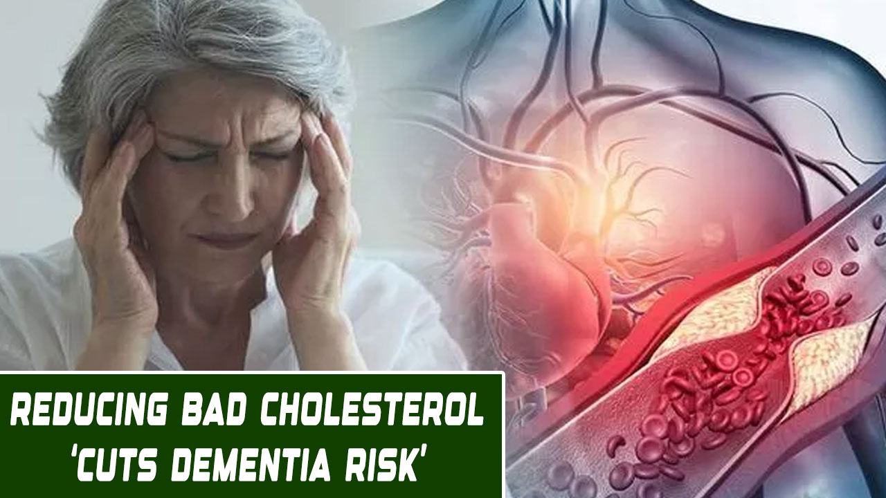 Lower Your Cholesterol, Save Your Memory? New Study Sparks Hope in Dementia Battle