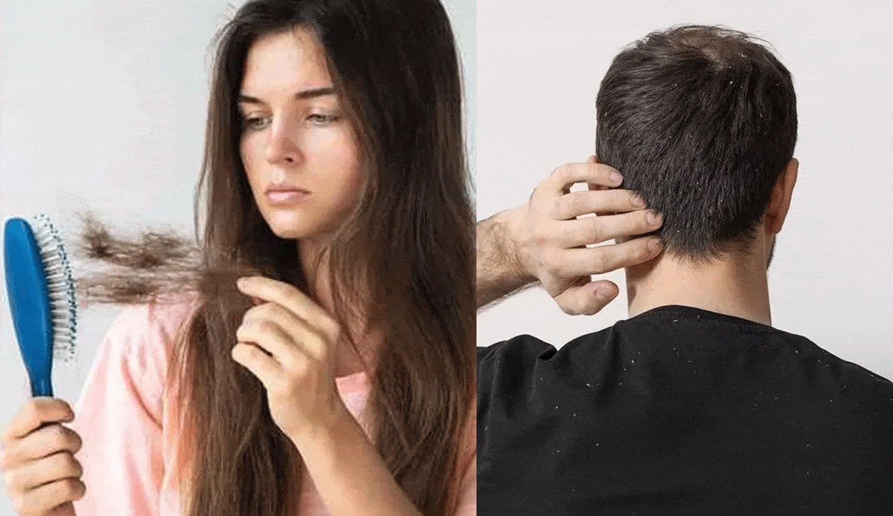Wow... Is Your Hair Falling Out More Than Usual? It Could Be a Sign of Damage in Your Body