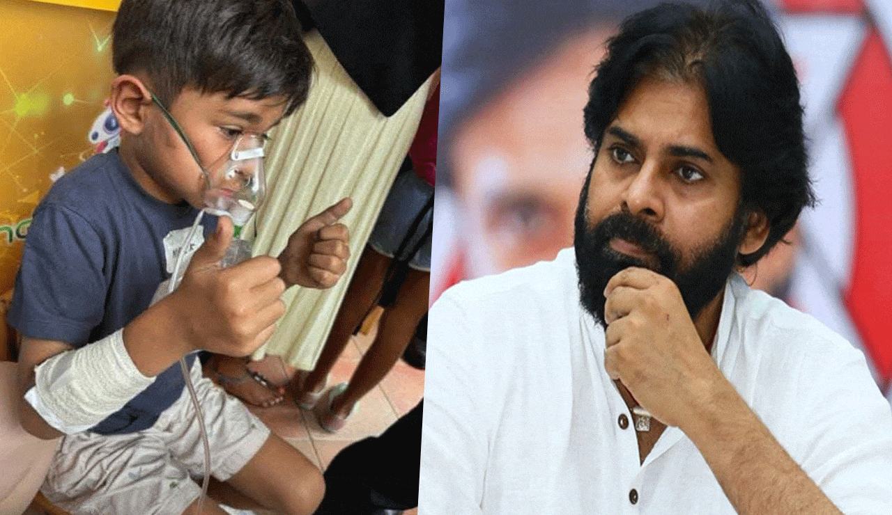 Pawan Kalyan's Son Mark Shankar Battling Trauma: Wakes Up Shocked at Midnight After Fire Incident