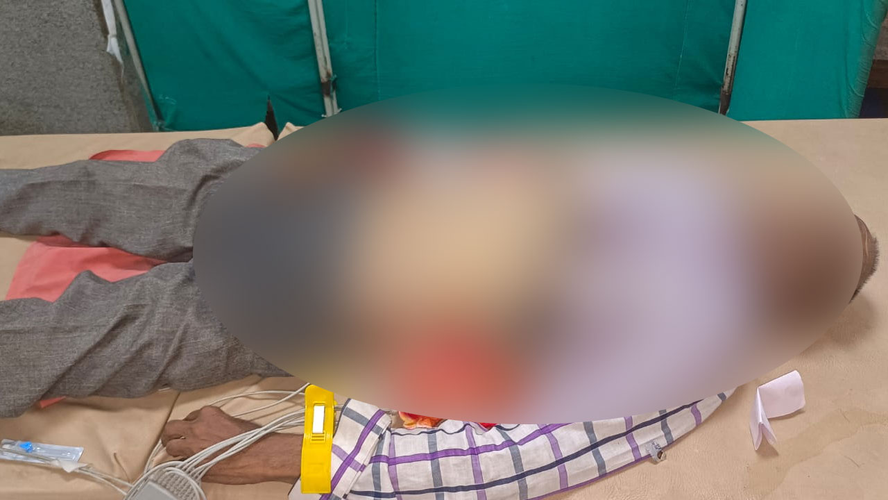 Hyderabad: Nampally Fish Prasadam Event Elderly Man Dies While Waiting in Queue