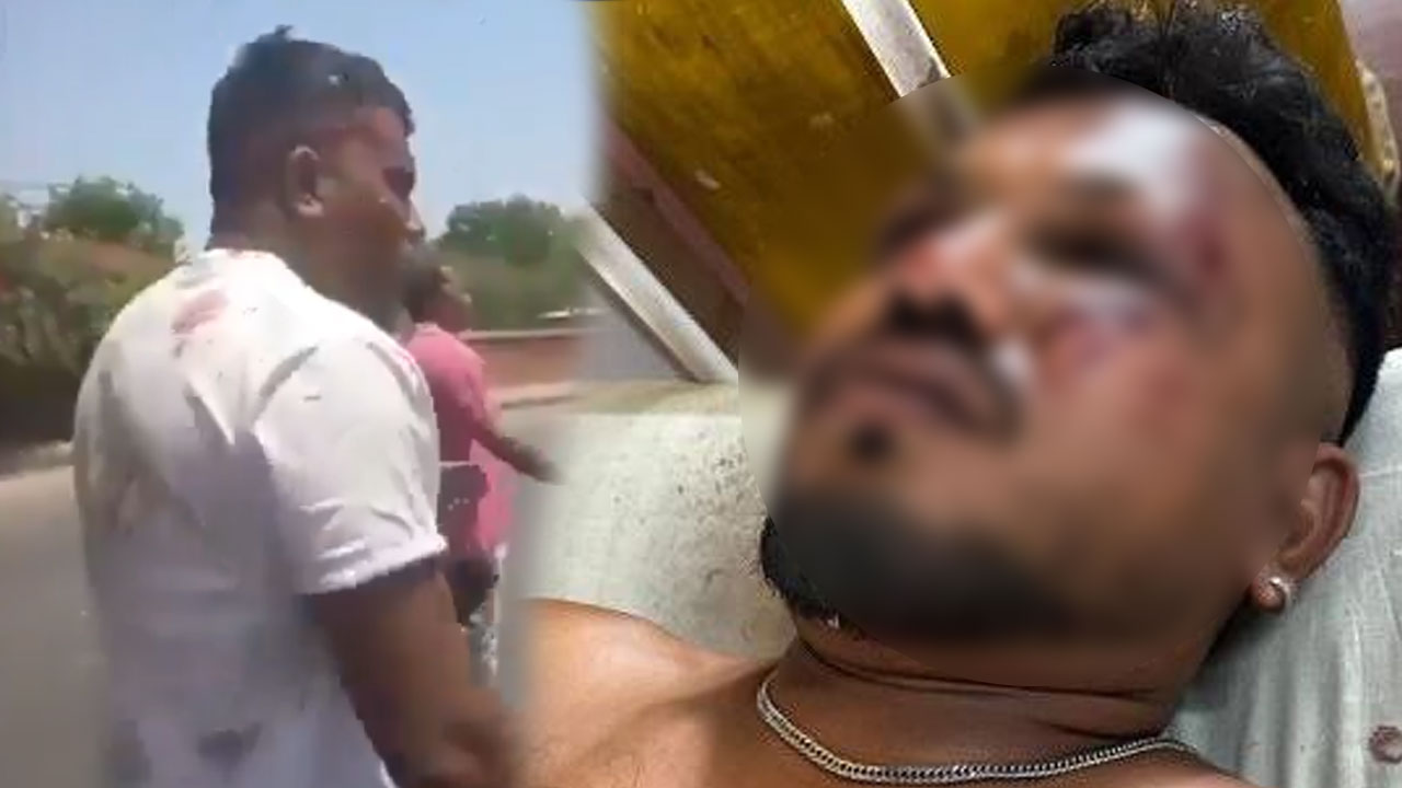 Ahmedabad Plane Crash Survivor Vishwas Recounts Terrifying Ordeal: “I Woke Up Surrounded by Dead Bodies and...”