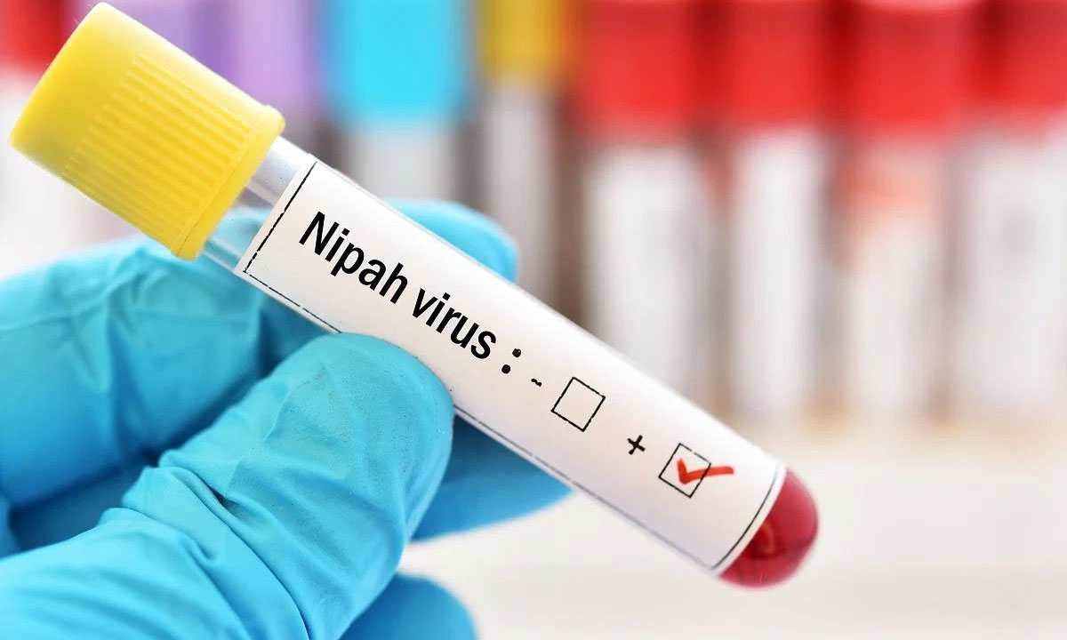 Nipah Virus Scare Returns in Kerala: Two Dead, over 380 Under Surveillance