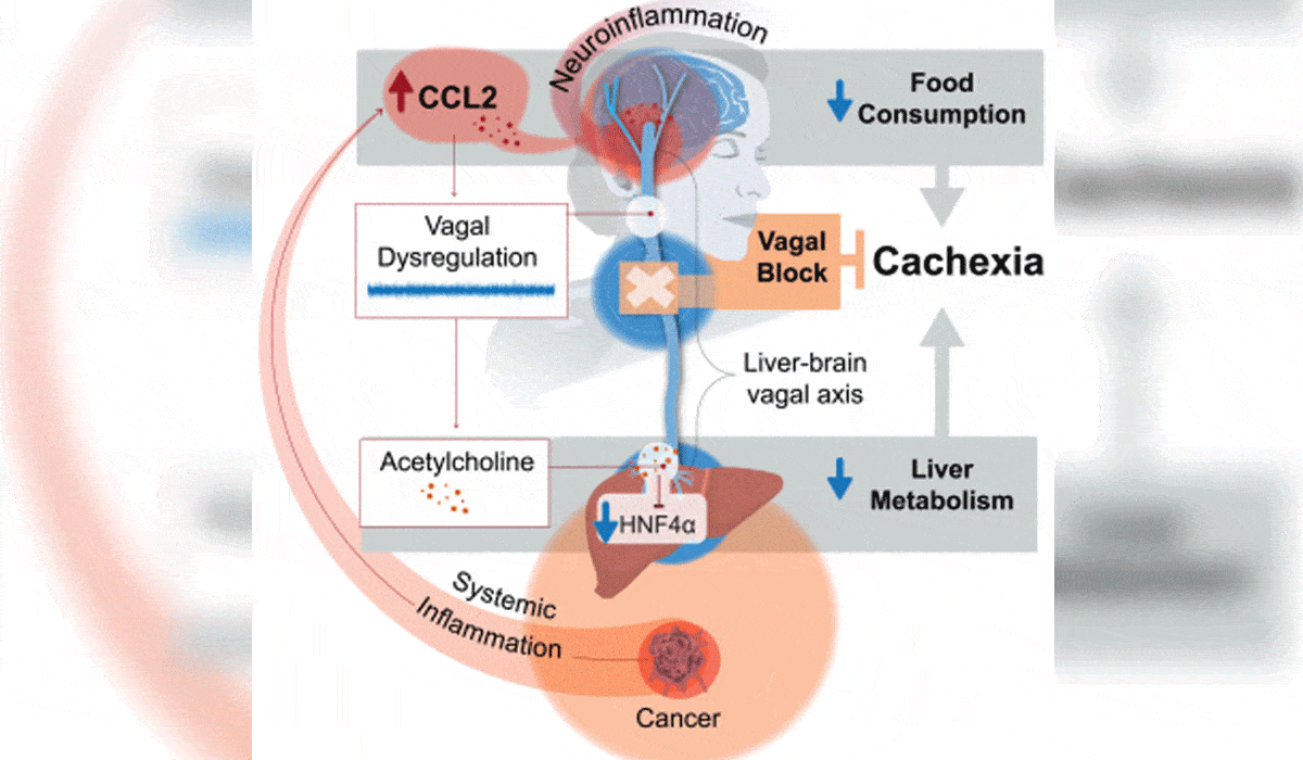 Study identifies reasons behind deadly weight loss in cancer patients