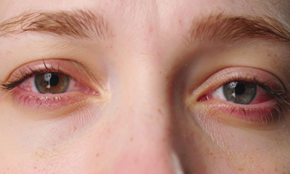 Just 1 hour of social media reels on smartphones can cause eye fatigue: Study