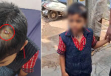 LKG Student Injured After Teacher Hits Him with Tiffin Box in Saeedabad School
