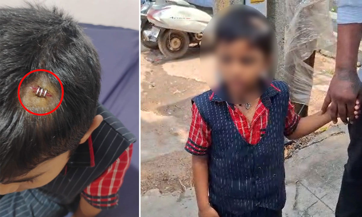 LKG Student Injured After Teacher Hits Him with Tiffin Box in Saeedabad School