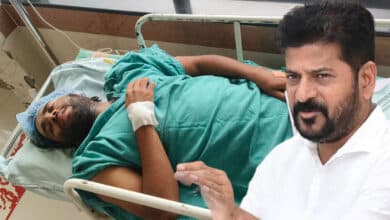 Telangana Chief Minister Revanth Reddy Gives Life to Accident Victim by Providing Artificial Legs