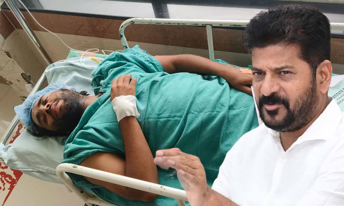 Telangana Chief Minister Revanth Reddy Gives Life to Accident Victim by Providing Artificial Legs