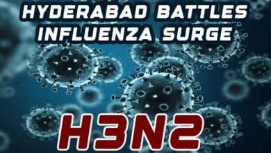 Hyderabad Battles Influenza Surge: 80% of Viral Fever Cases Linked to H3N2