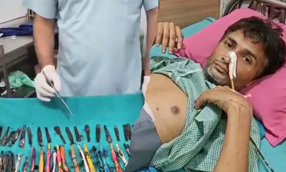 Surgical team at Dev Nandini Hospital successfully removed 50 foreign objects from a patient's stomach in a complex procedure.