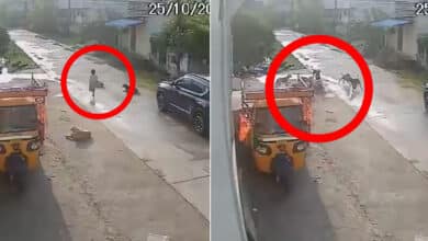 Telangana Tragedy: Child Seriously Injured in Stray Dog Attack; Locals Demand Action