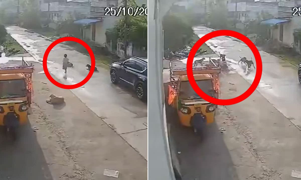 Telangana Tragedy: Child Seriously Injured in Stray Dog Attack; Locals Demand Action