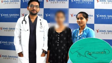 Rare Genetic Pancreatitis Surgery Performed Successfully on 17-Year-Old Girl at KIMS Saveera, Anantapur