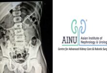 Eight-Year-Old with Kidney Full of Stones Successfully Treated at AINU Hyderabad in Single PCNL Procedure