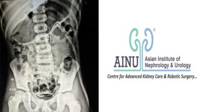 Eight-Year-Old with Kidney Full of Stones Successfully Treated at AINU Hyderabad in Single PCNL Procedure