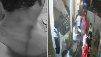 Attempted Murder in Bowenpally: Man Attacked by Wife’s Relatives Over Family Dispute