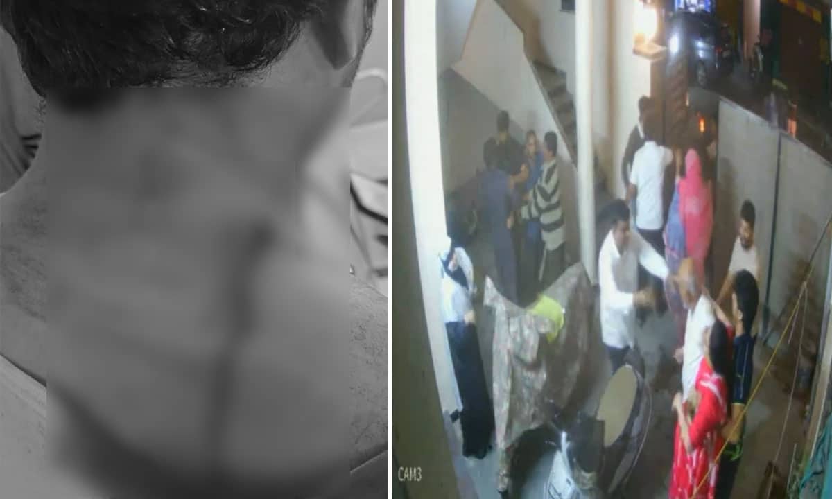 Attempted Murder in Bowenpally: Man Attacked by Wife’s Relatives Over Family Dispute