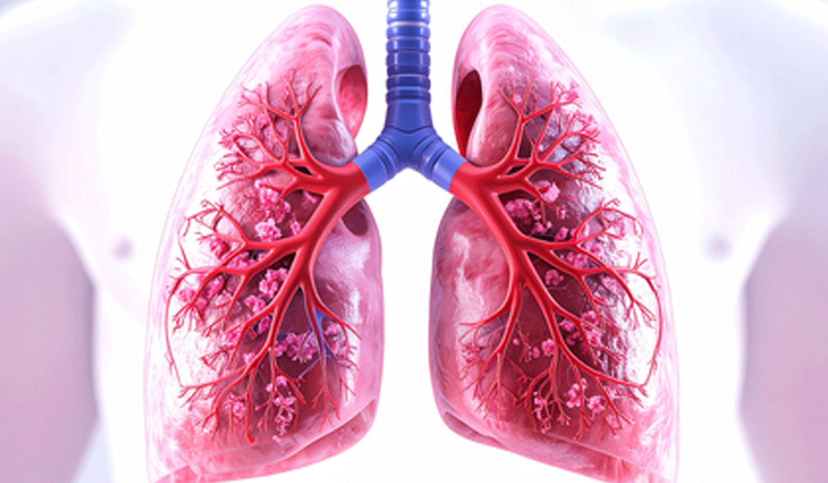 New blood test can detect, monitor lung cancer in real time