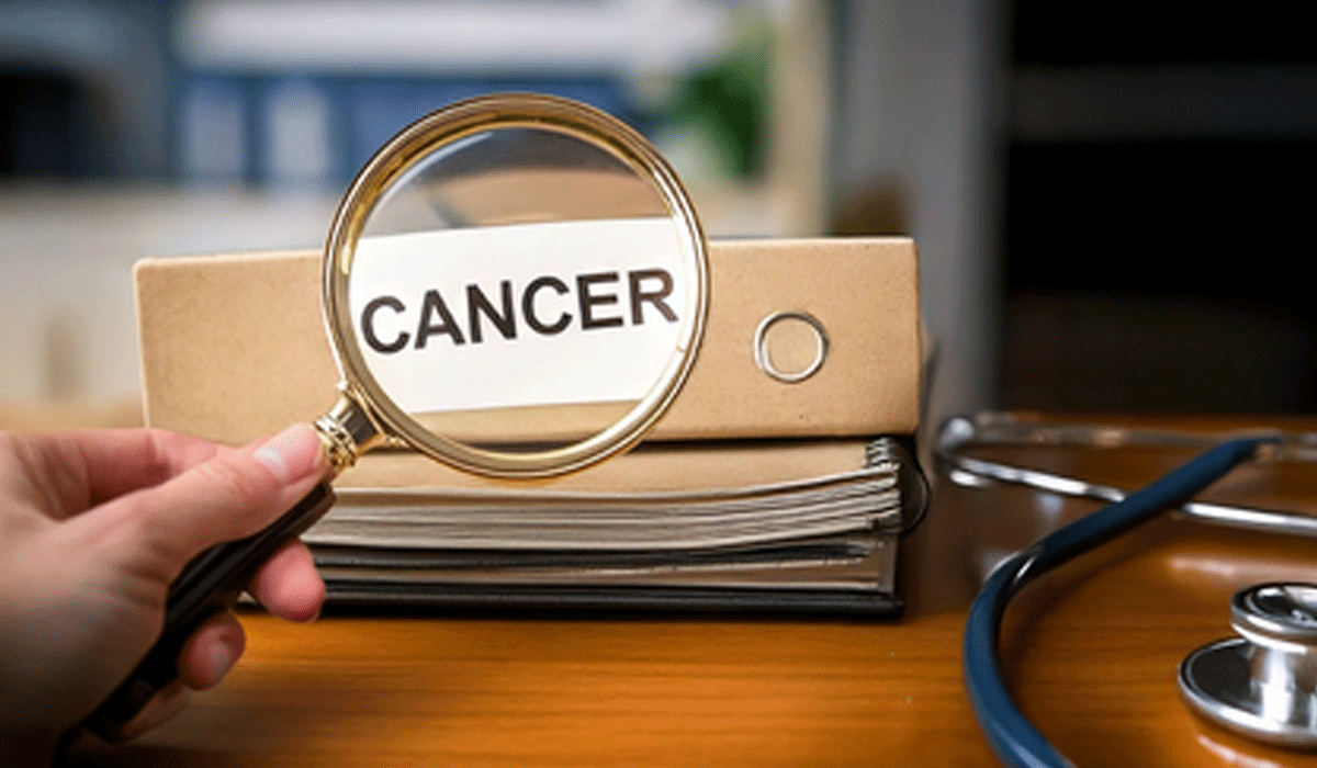 Study shows a stiffer colon may raise the risk of early-onset colorectal cancer