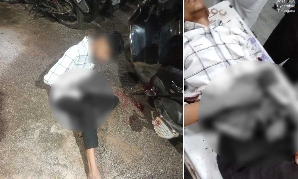 Hyderabad Horror, Love Dispute Turns Violent, Teen Critically Injured as Internal Organs Were Exposed in Brutal Attack