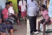 Telangana Shocker, Mad Dog Goes on Rampage, 36 People Injured