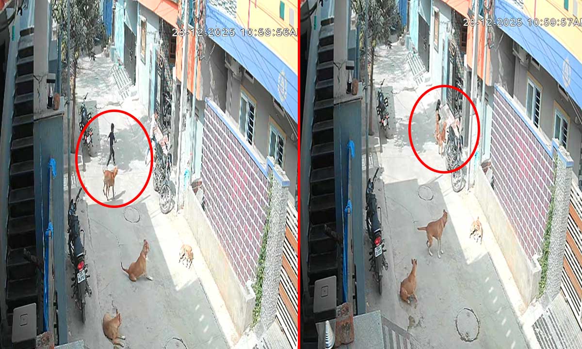 Stray Dog Menace: Five-Year-Old Child Injured in Attack, Locals Allege Official Negligence