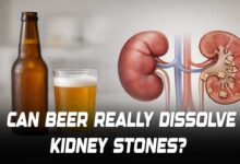 Can Beer Really Dissolve Kidney Stones? Here is What Doctors Says