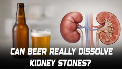 Can Beer Really Dissolve Kidney Stones? Here is What Doctors Says