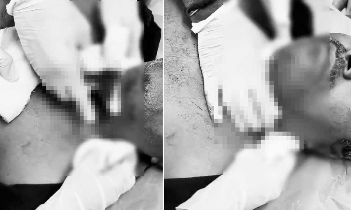 Deadly Chinese Manja Strikes Again in Hyderabad, Man’s Throat Severely Injured