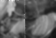 Hyderabad Shock: Two Senior Citizens Found Dead in Locked Flat Under Mirchowk Police Limits