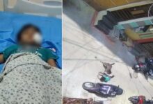 Dog Attack on Child Near Khairatabad Ganesh Pandal, UKG Student Under Treatment at Rainbow Hospital