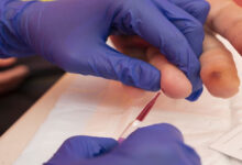 World-first fingerstick test to expand hepatitis B diagnosis access