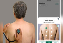 AI-powered digital stethoscopes show promise in