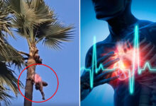 Telangana Tragedy: Toddy Tapper Dies of Heart Attack While Working on Palm Tree