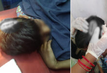 Hyderabad School Incident: Student Injured in Classroom Fight at Jiyaguda